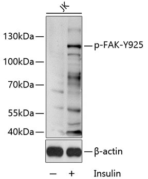 Phospho-FAK (Tyr925) Antibody in Western Blot (WB)