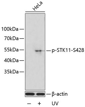 Phospho-LKB1 (Ser428) Antibody in Western Blot (WB)