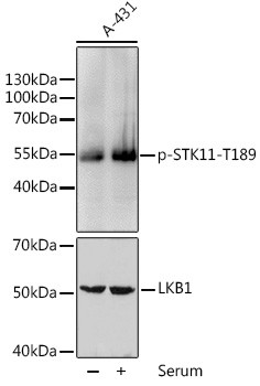 Phospho-LKB1 (Thr189) Antibody in Western Blot (WB)
