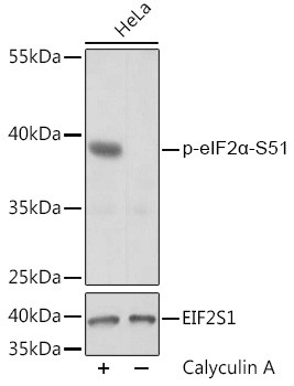 Phospho-EIF2S1 (Ser51) Antibody in Western Blot (WB)
