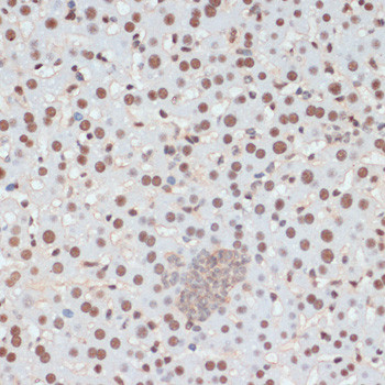 Phospho-p53 (Ser33) Antibody in Immunohistochemistry (Paraffin) (IHC (P))