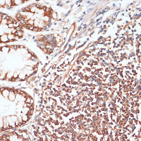 Phospho-VASP (Ser157) Antibody in Immunohistochemistry (Paraffin) (IHC (P))