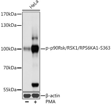 Phospho-RSK1 (Ser363) Antibody in Western Blot (WB)