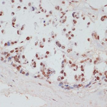 Phospho-MSK1 (Ser376) Antibody in Immunohistochemistry (Paraffin) (IHC (P))