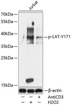 Phospho-LAT (Tyr171) Antibody in Western Blot (WB)