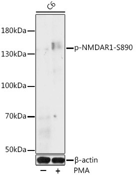 Phospho-NMDAR1 (Ser890) Antibody in Western Blot (WB)