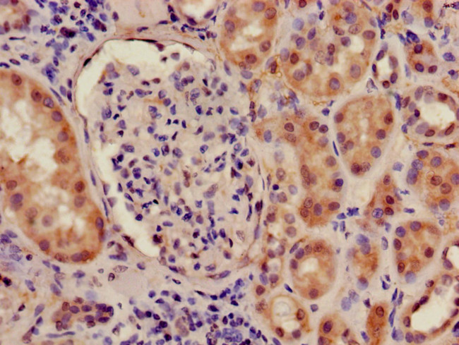 ILF2 Antibody in Immunohistochemistry (Paraffin) (IHC (P))