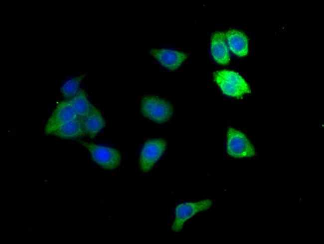Alcohol Dehydrogenase 1B Antibody in Immunocytochemistry (ICC/IF)