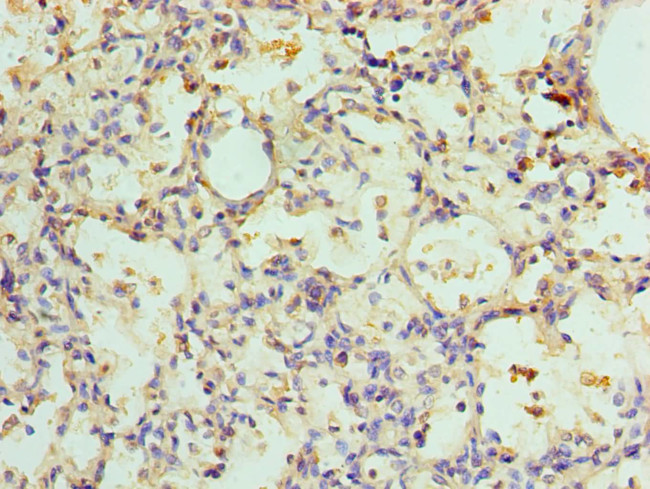 ADSL Antibody in Immunohistochemistry (Paraffin) (IHC (P))