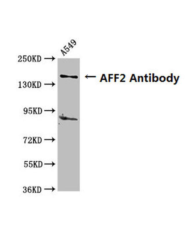 AFF2 Antibody in Western Blot (WB)