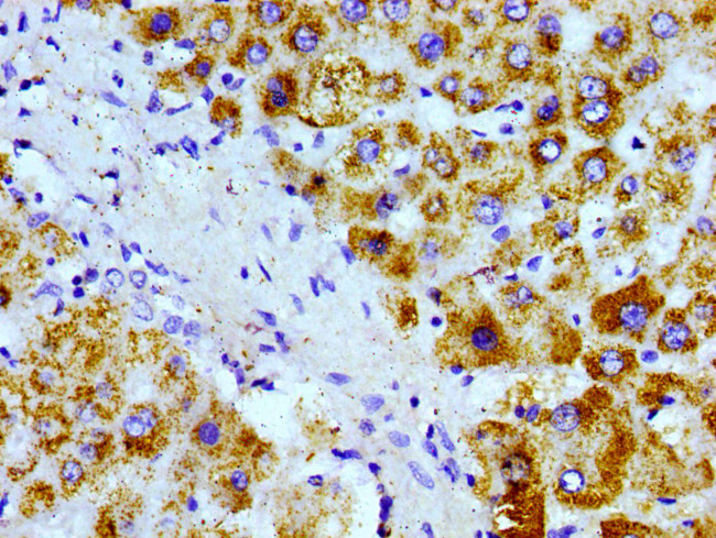 AGXT Antibody in Immunohistochemistry (Paraffin) (IHC (P))