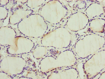 ALAS2 Antibody in Immunohistochemistry (Paraffin) (IHC (P))