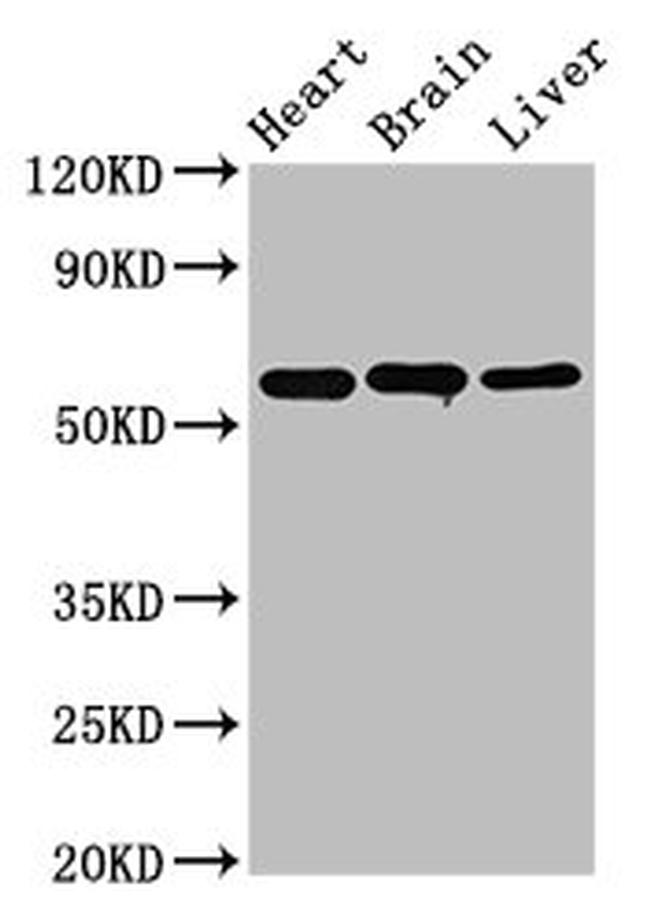 ALDH5A1 Antibody in Western Blot (WB)
