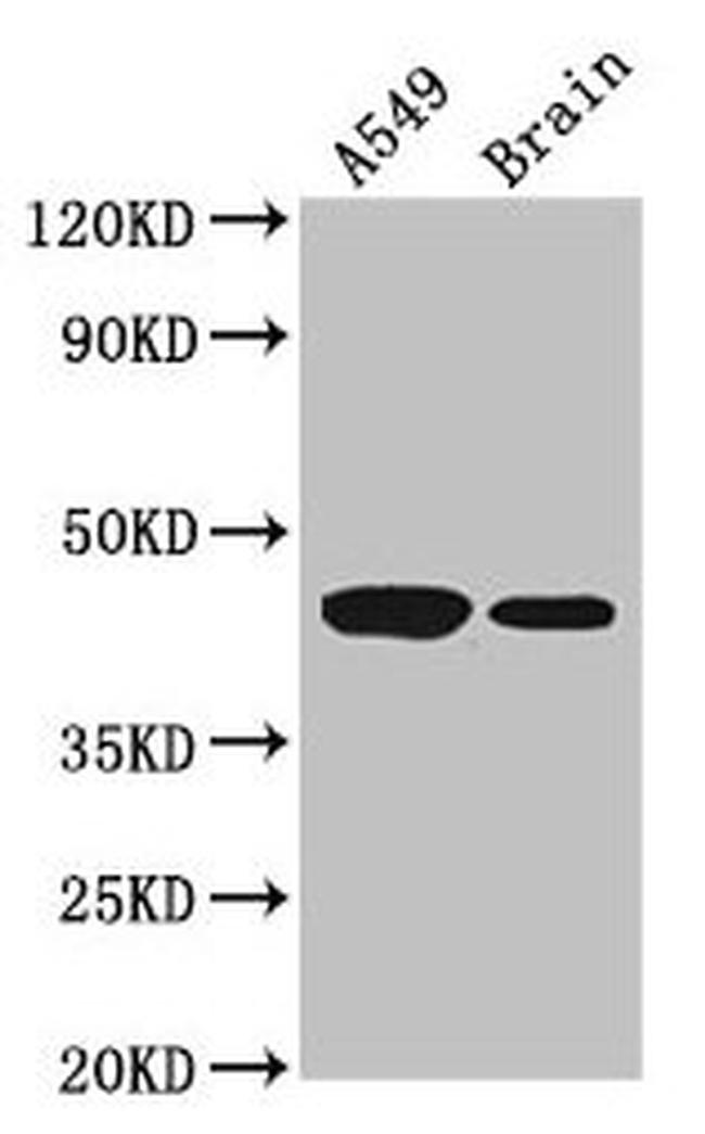 AMT Antibody in Western Blot (WB)