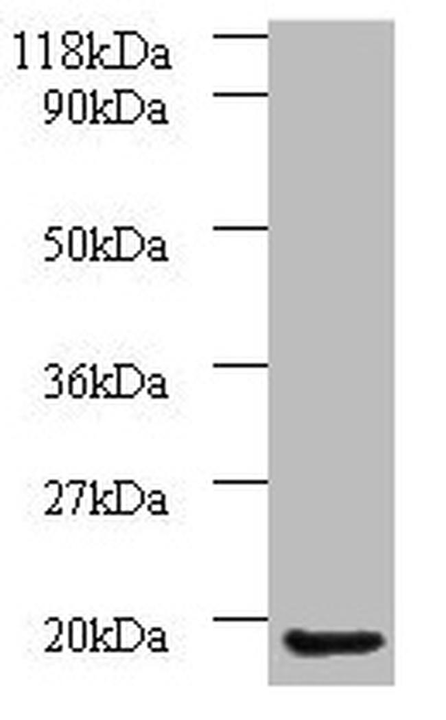 AP1S3 Antibody in Western Blot (WB)