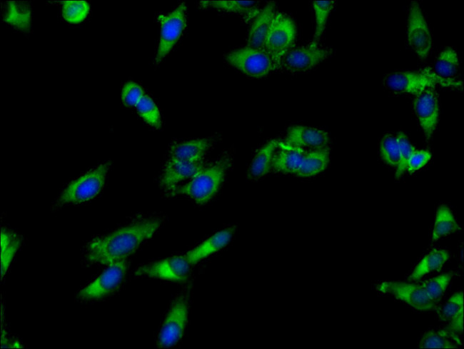 APEH Antibody in Immunocytochemistry (ICC/IF)