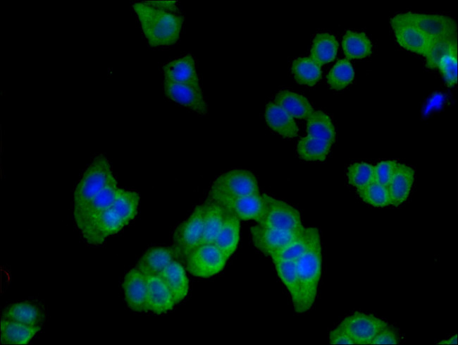 D4-GDI Antibody in Immunocytochemistry (ICC/IF)