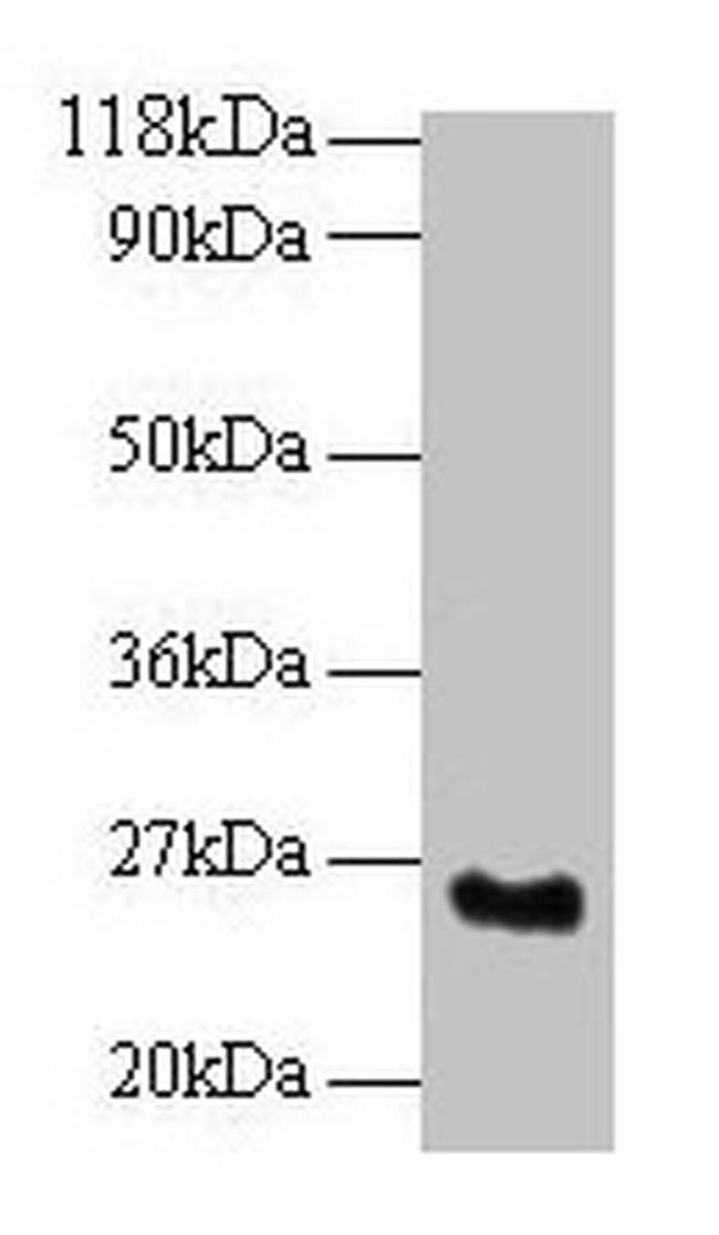 SRSF9 Antibody in Western Blot (WB)