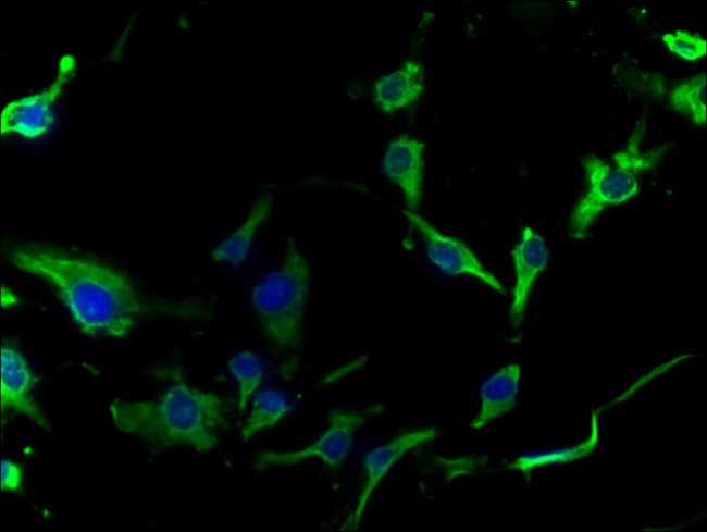 ASAH2 Antibody in Immunocytochemistry (ICC/IF)
