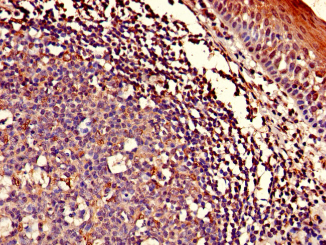 ASCC1 Antibody in Immunohistochemistry (Paraffin) (IHC (P))