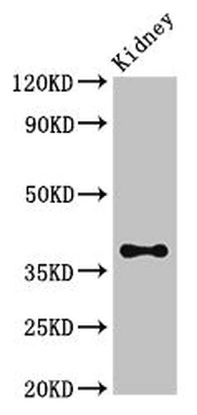 ATOH1 Antibody in Western Blot (WB)