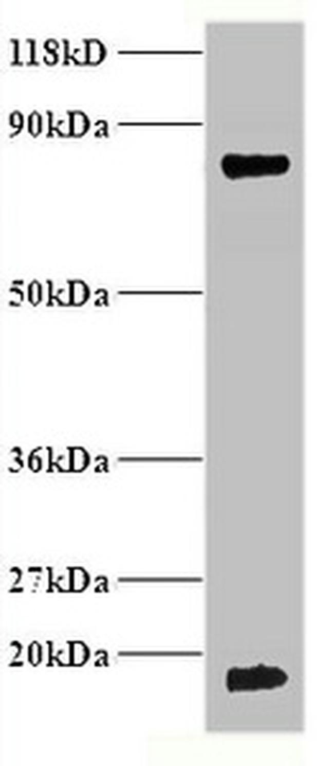 Hemoglobin Antibody in Western Blot (WB)