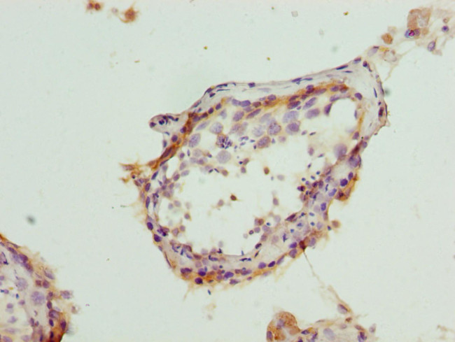 BAP29 Antibody in Immunohistochemistry (Paraffin) (IHC (P))