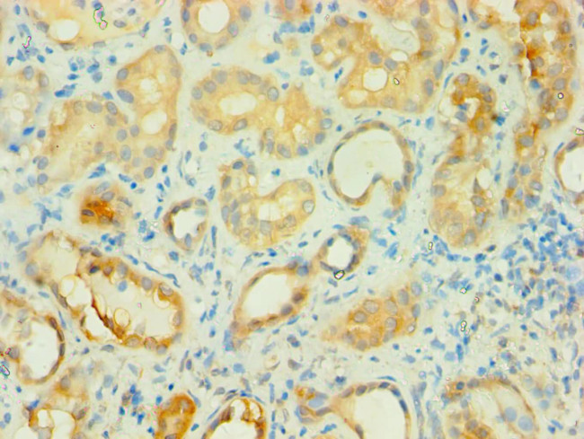 BCAT2 Antibody in Immunohistochemistry (Paraffin) (IHC (P))