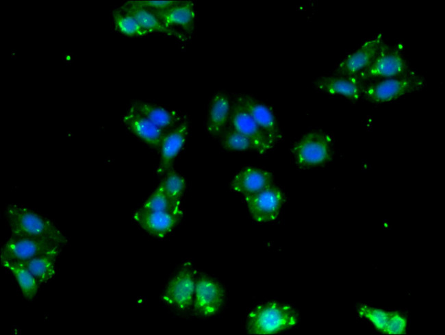 BPI Antibody in Immunocytochemistry (ICC/IF)