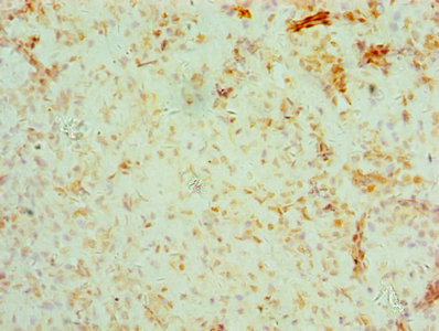 BRCC3 Antibody in Immunohistochemistry (Paraffin) (IHC (P))