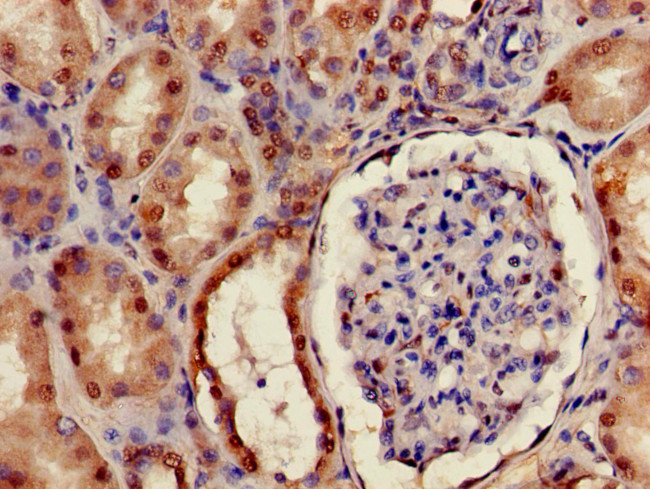 C21orf63 Antibody in Immunohistochemistry (Paraffin) (IHC (P))