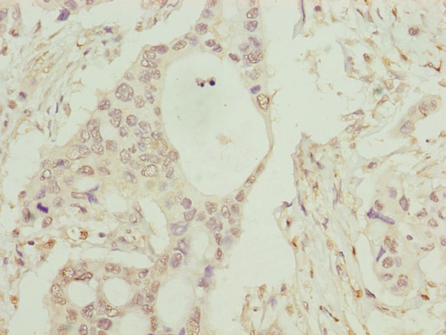 C8B Antibody in Immunohistochemistry (Paraffin) (IHC (P))