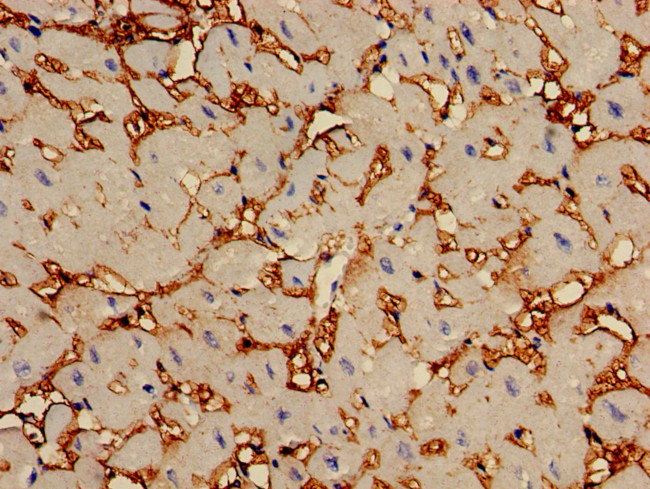 CAP2 Antibody in Immunohistochemistry (Paraffin) (IHC (P))