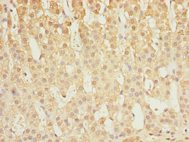 Calpain S1 Antibody in Immunohistochemistry (Paraffin) (IHC (P))