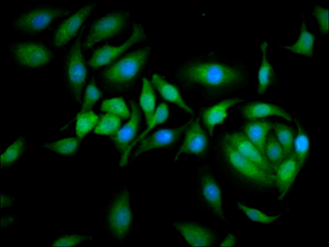 Calpastatin Antibody in Immunocytochemistry (ICC/IF)