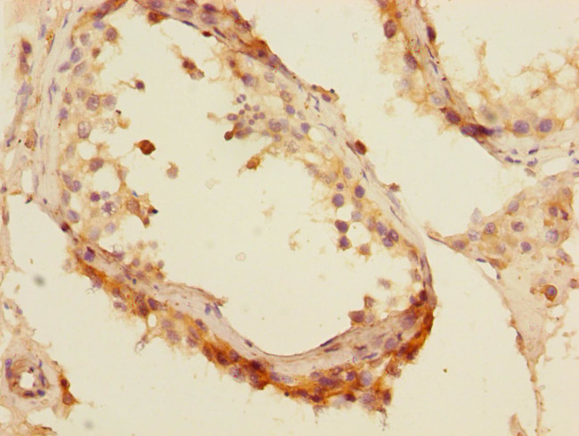 MTGR1 Antibody in Immunohistochemistry (Paraffin) (IHC (P))