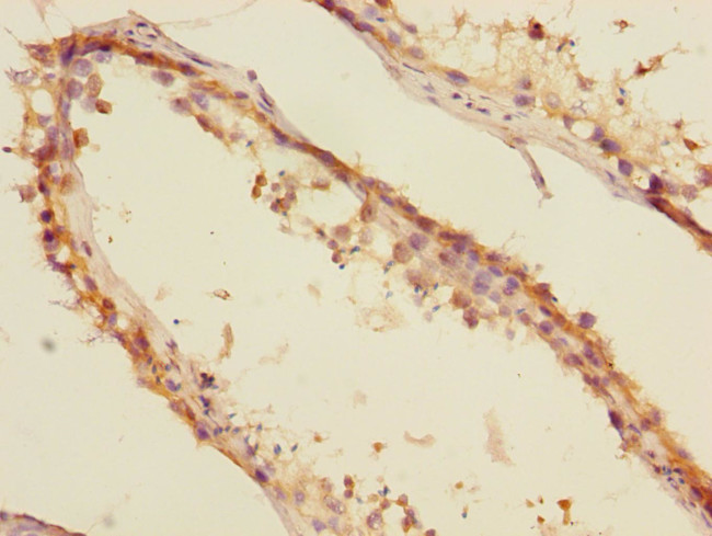 MTGR1 Antibody in Immunohistochemistry (Paraffin) (IHC (P))
