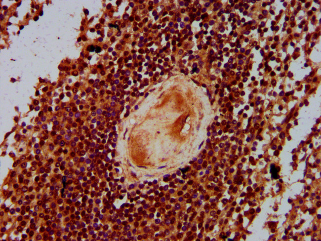 MTG16 Antibody in Immunohistochemistry (Paraffin) (IHC (P))