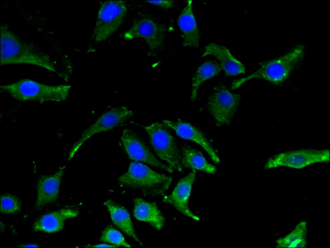 CBR1 Antibody in Immunocytochemistry (ICC/IF)
