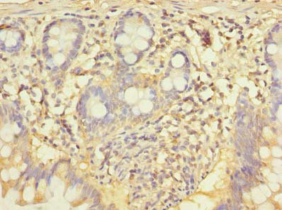 CCNJL Antibody in Immunohistochemistry (Paraffin) (IHC (P))
