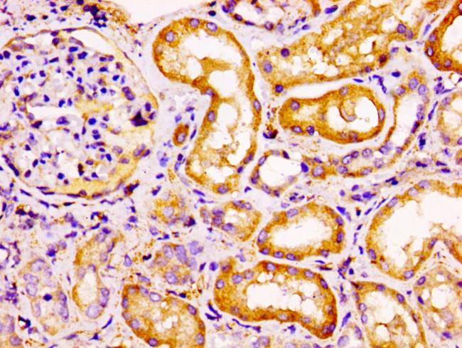 CCRL2 Antibody in Immunohistochemistry (Paraffin) (IHC (P))