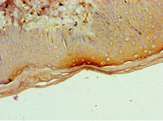 CD1a Antibody in Immunohistochemistry (Paraffin) (IHC (P))