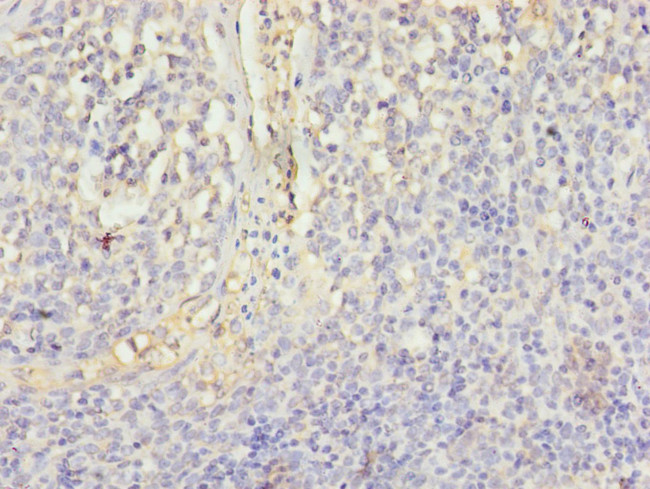 CD46 Antibody in Immunohistochemistry (Paraffin) (IHC (P))