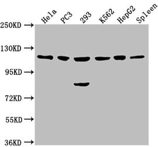 CDKL5 Antibody in Western Blot (WB)