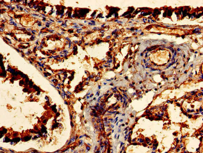 CDR2 Antibody in Immunohistochemistry (Paraffin) (IHC (P))