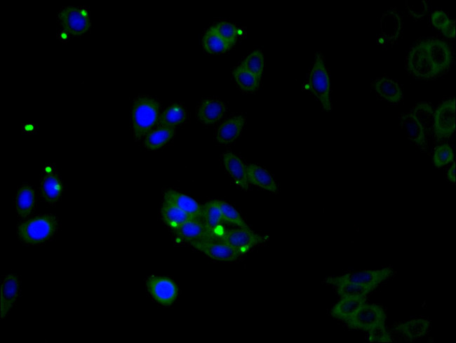CDSN Antibody in Immunocytochemistry (ICC/IF)
