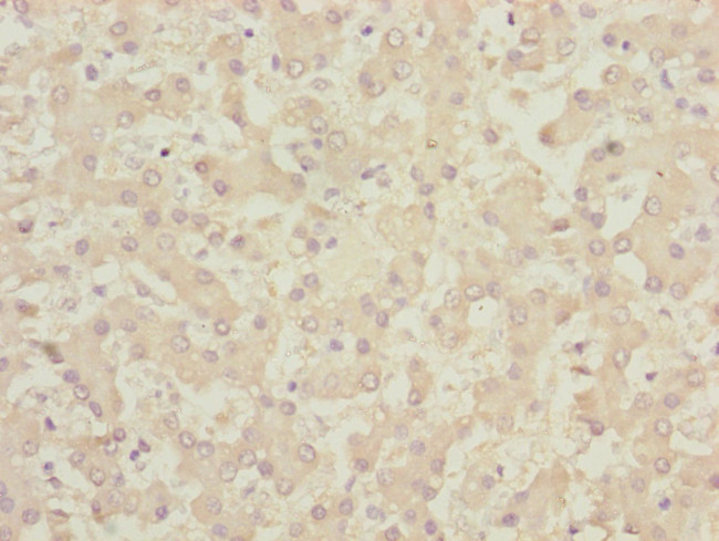 CENPK Antibody in Immunohistochemistry (Paraffin) (IHC (P))