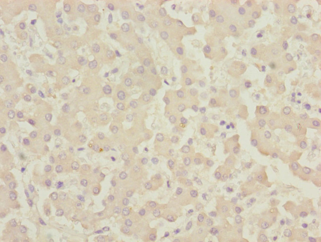 CENPK Antibody in Immunohistochemistry (Paraffin) (IHC (P))