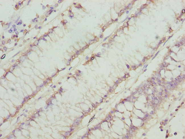 CHN1 Antibody in Immunohistochemistry (Paraffin) (IHC (P))