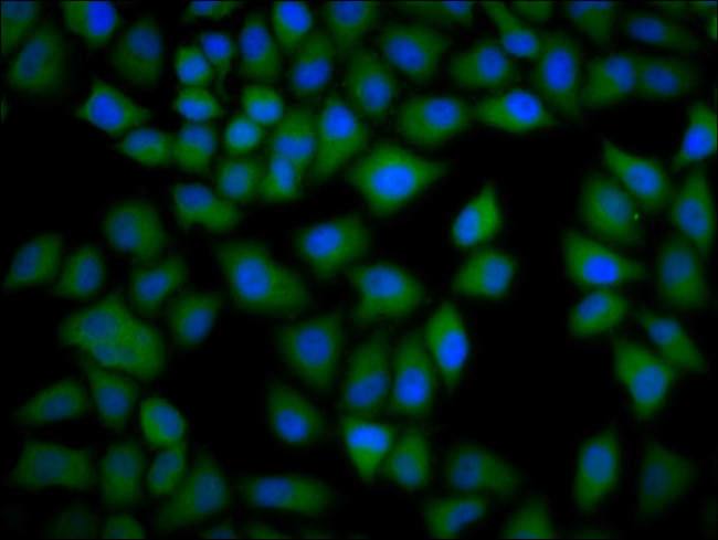 CKAP4 Antibody in Immunocytochemistry (ICC/IF)
